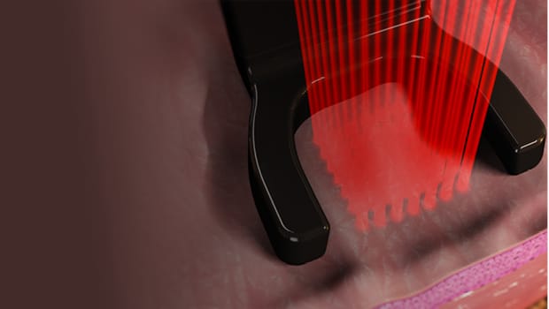 Bio-stimolazione e laser: la scienza dietro Harmony Bio-Boost