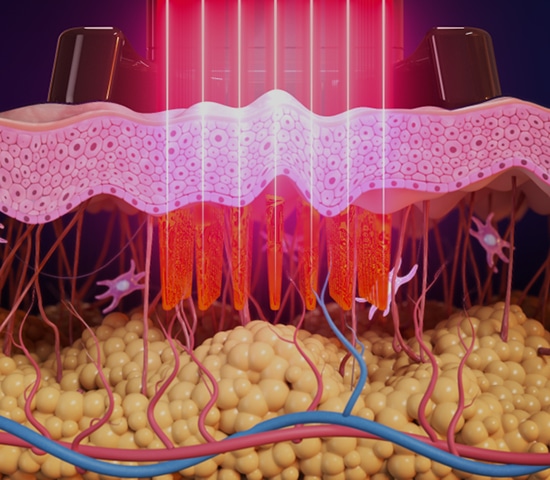 Il ruolo del collagene e dell’elastina